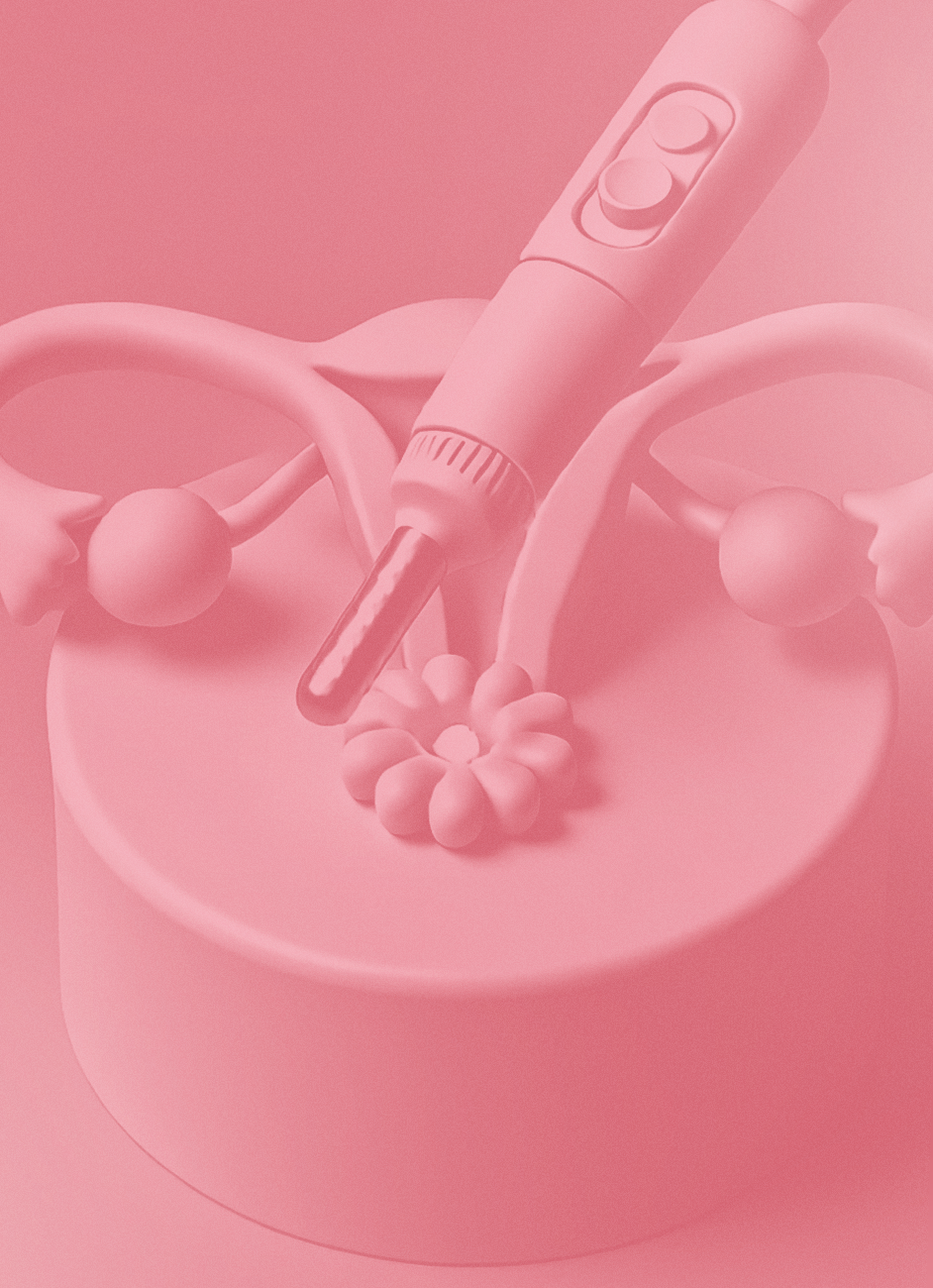 Cauterização de Lesões de HPV